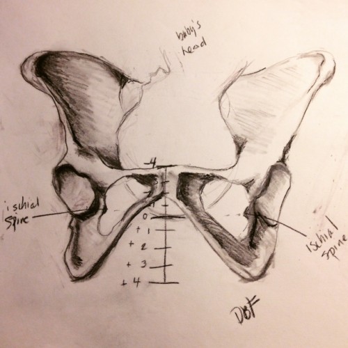 Baby low in clearance pelvis